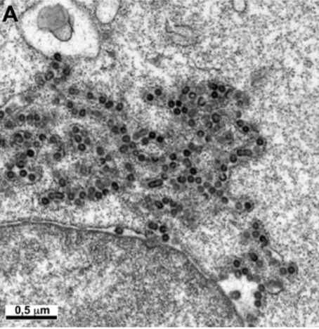 Intracisternsl_A-type_1